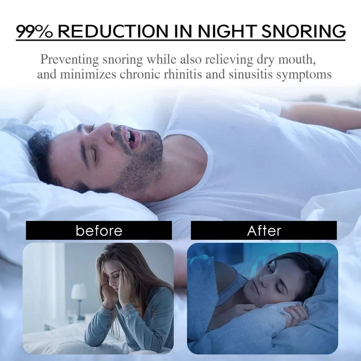 Want a sharper jawline? Start by closing your mouth at night.